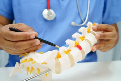 Hernia de disc și durerile de spate: soluții minim invazive la Terapia Durerii medic care explica ce este hernia de disc pe o coloana