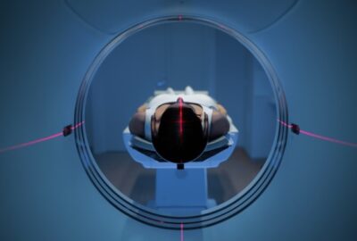 Cel mai performant RMN din țară, la Grupul Medical NORD din București Aparatul de RMN Magnetom Skyra 3T la Centrul Medical Provita Bucuresti