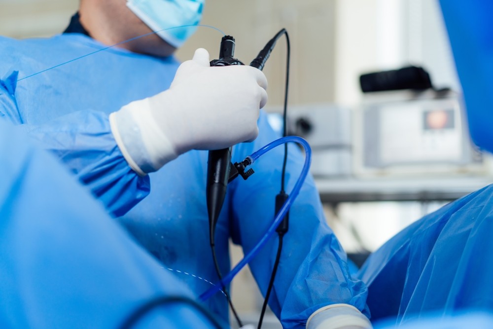 Reprezentare grafica a unei proceduri de endoscopie digestiva superioara