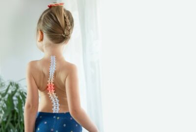 Scolioza la copii – depistarea precoce și tratamentul conservator copil cu scolioza