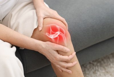 Artroza genunchiului (Gonartroza) – cauze, simptome, stadii, diagnostic și tratament Imagine cu un genunchi afectat de artroza
