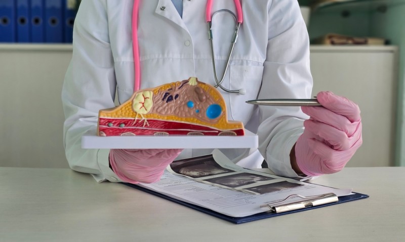 Imagine cu un doctor care discuta despre diagnosticul de cancer la san