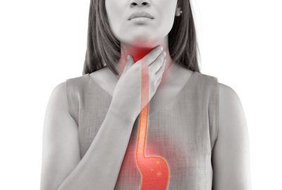 Hernia hiatală și boala de reflux gastro-esofagian: cauze, simptome, tratament și recuperare după operație Boala de reflux gastro-esofagian ilustrata