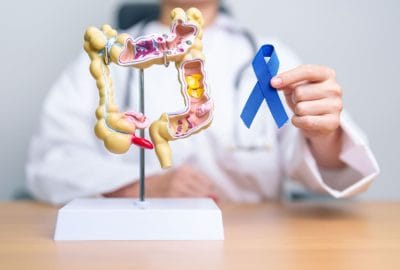 concept cancer colorectal 