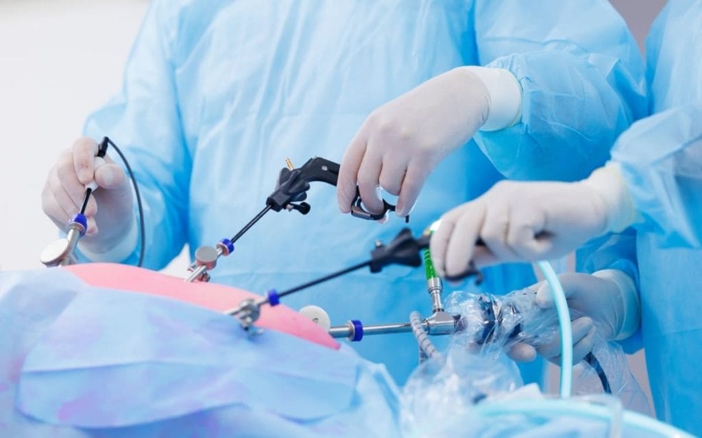 chirurgie laparoscopica