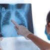 medic examineaza radiografie pulmonara 