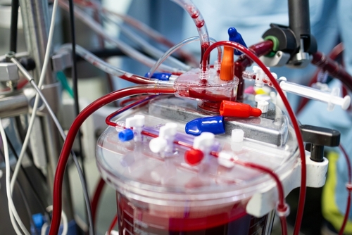 Mașină de bypass cardiopulmonar, rezervor de sânge în timpul intervenției chirurgicale cardiace, salvarea de vieți în sala de operație, echipament medical în fundal. Echipament medical și îngrijire medicală.