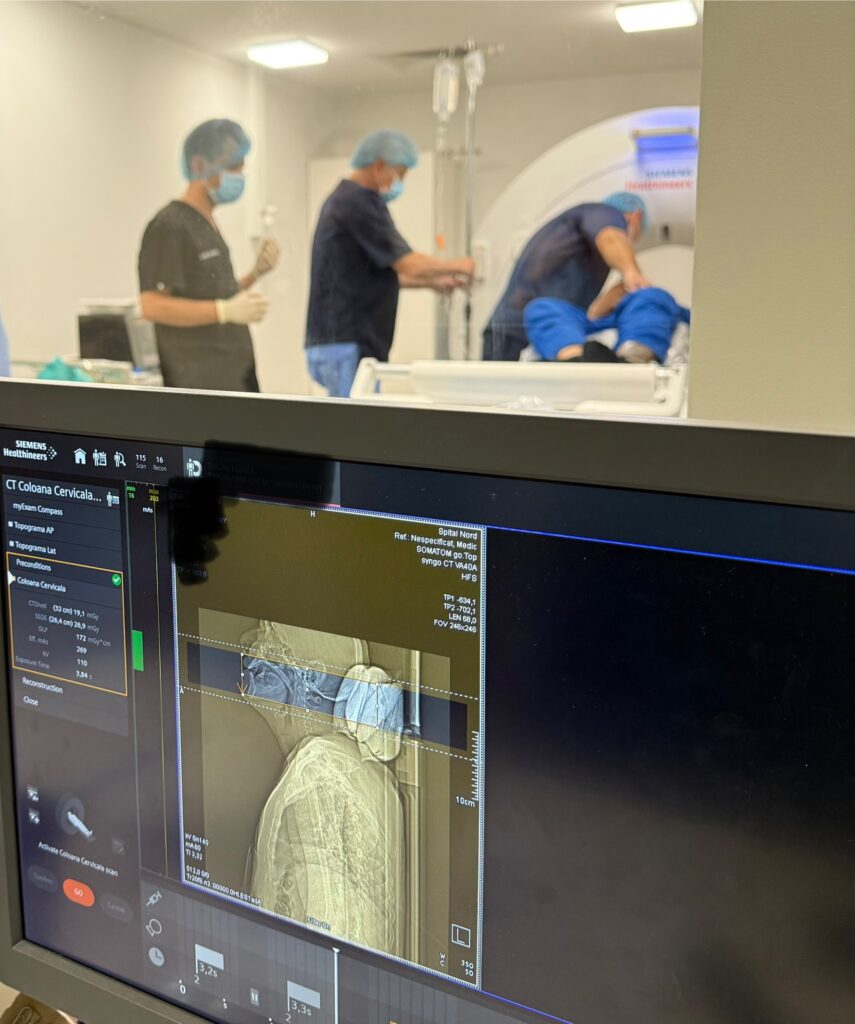 Cordotomie in oncologie Terapia Durerii