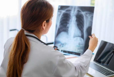 Ce întrebări să adresezi chirurgului tău toracic înainte de operație: un ghid pentru pacienți Ce întrebări să adresezi chirurgului tău toracic înainte de operație: un ghid pentru pacienți