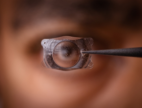Fotografie a unei lentile implantabile din colamer (ICL) utilizate pentru corectarea erorilor de refracție, surprinsă în fața unei surse de lumină.