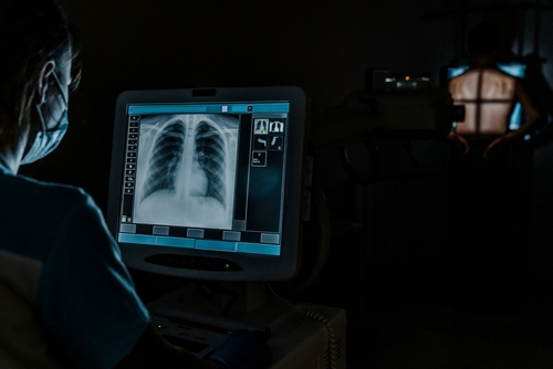 Pacient în picioare, poziționat cu fața spre perete, în timp ce medicul îl scanează cu aparatul de radiografie în întuneric; imagine de radiografie pulmonară, concept de pneumologie și prevenție a infecției cu coronavirus.