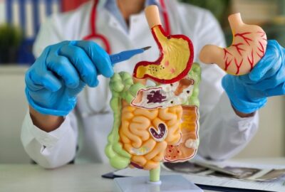 Impactul chirurgiei bariatrice asupra afecțiunilor asociate obezității – diabet, hipertensiune și boli cardiovasculare Imagine cu un pacient care a suferit o schimbare semnificativa dupa operatia bariatrica