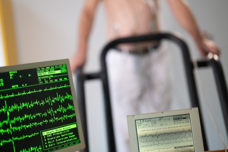 Rezultatele unui test EKG de efort afișate pe monitor