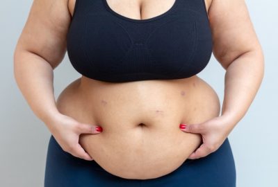 Avantaje și dezavantaje ale inelului gastric: Este potrivit pentru tine? O imagine reprezentand o balanta, cu avantajele si dezavantajele inelului gastric