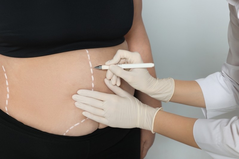 Imaginea ilustrează pregătirea înainte de operație