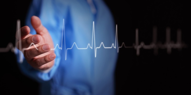 ecg
