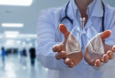 Tratamentul tumorilor pulmonare prin chirurgie robotică: ghid complet pentru pacienți Imagine cu chirurgie robotica pentru tumori pulmonare