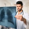 Imagine cu noduli pulmonari