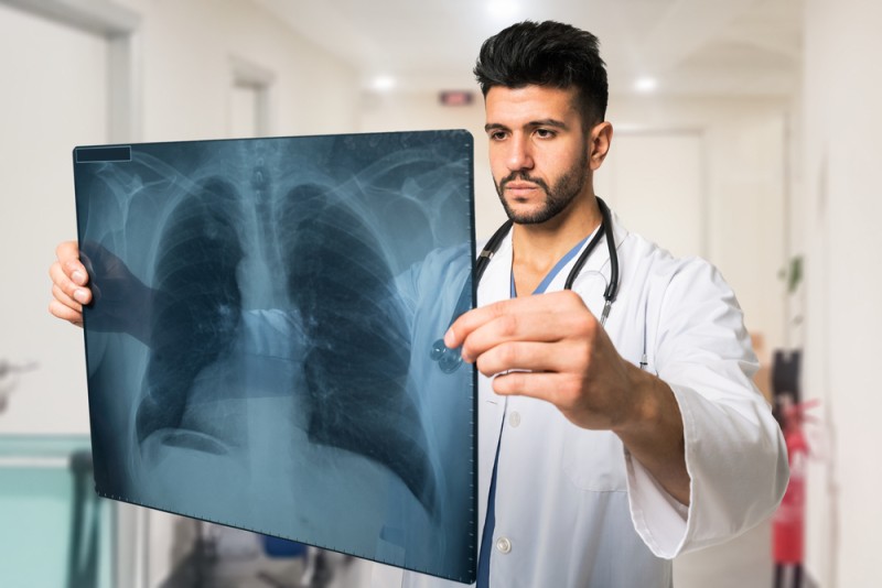 Imagine cu noduli pulmonari