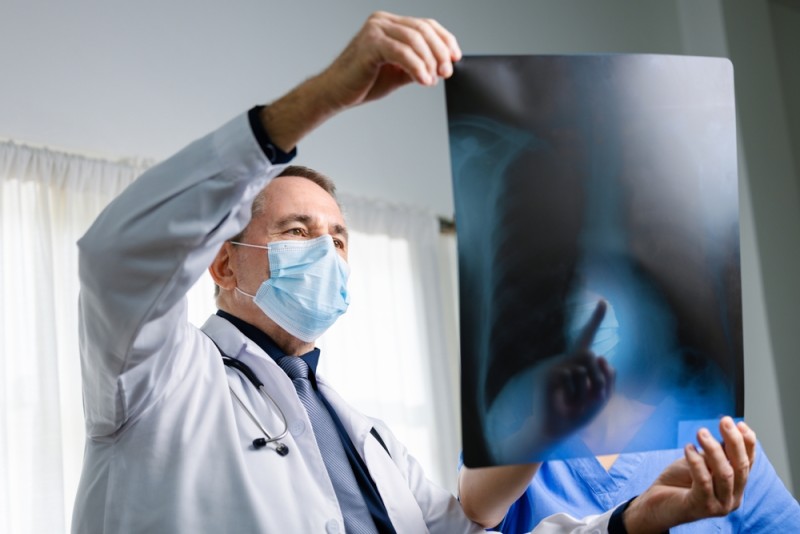 tratament pentru cancerul pulmonar